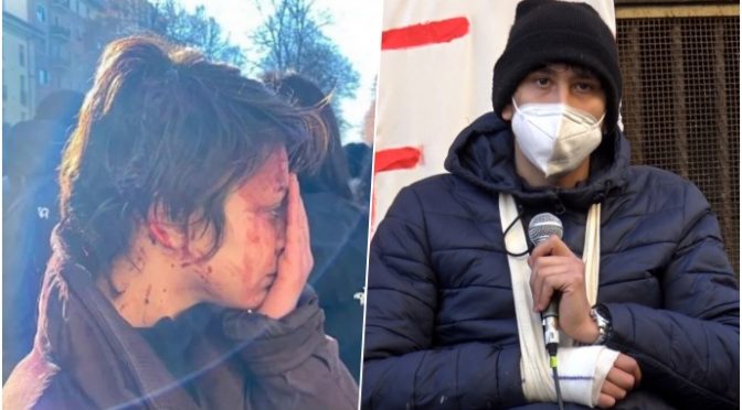 Lamorgese manganella gli italiani invece degli invasori: “Manganellata anche dopo che mi avevano spaccato la testa” – VIDEO